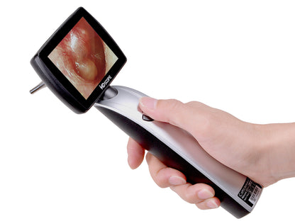 Video-otoscop MD Scope MS102 – pachet Elite – imagine 2