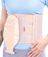 Corset abdominal pentru stomă STOMATEX DUO – Triamed SRT 135 – imagine 1